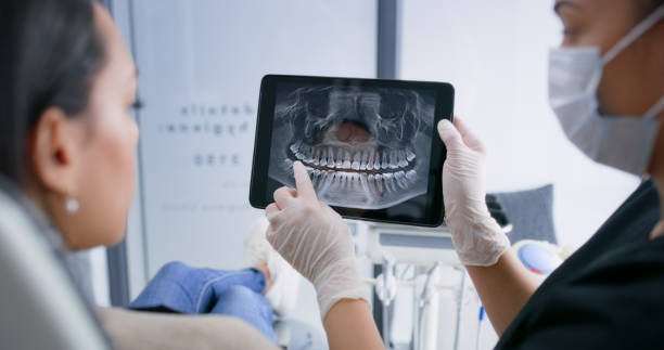 Licensed Tooth Extraction service in Henderson, TX - Smile Center Dentistry